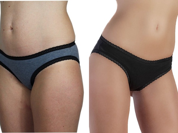 4 Er Pack Mix Damen Slip Spitze Bio-baumwolle Bikinislip "Albero" günstig online kaufen